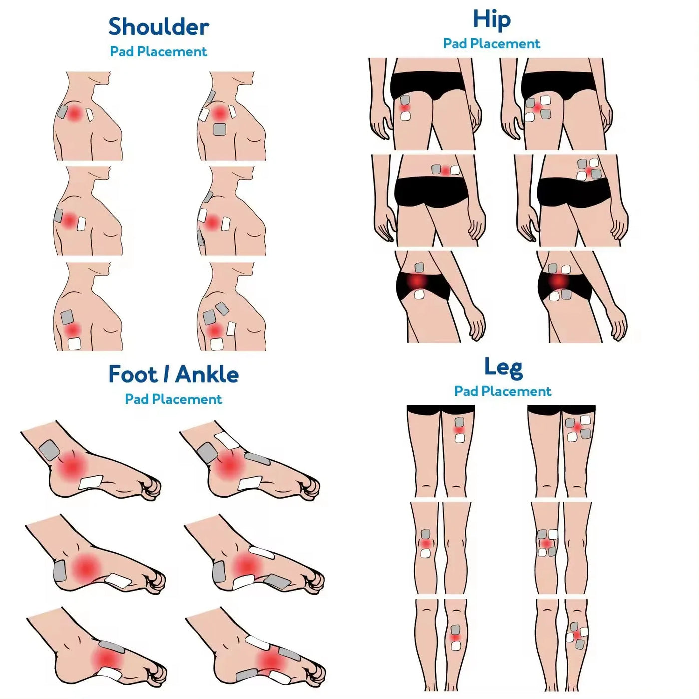 Electric Muscle Therapy Stimulator High-Frequency Interferential Physiotherapy Device